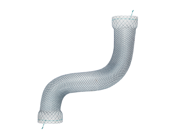 Taewoong_Niti-S™ MEGA™ Esophageal Stent