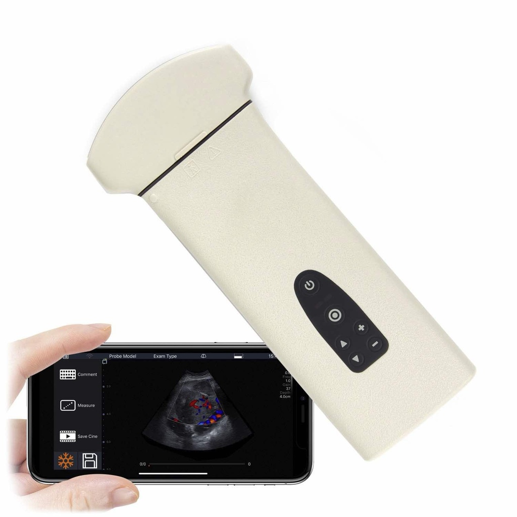 Ultrasonido ultraportatil de alta tecnología D8 - Imagen 2