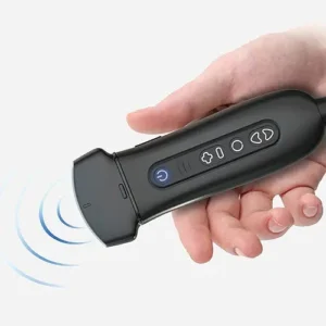 Ultrasonido ultraportatil de alta tecnología P50